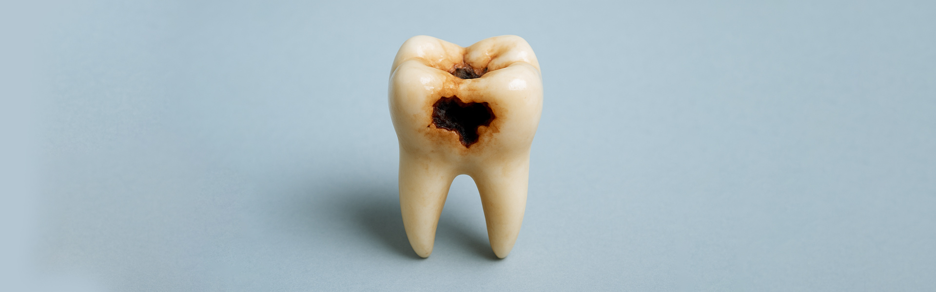 How to Remove Tooth Decay Before It Gets Worse
