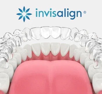 Why Do My Invisalign Aligners Turn Yellow? When to Replace Them